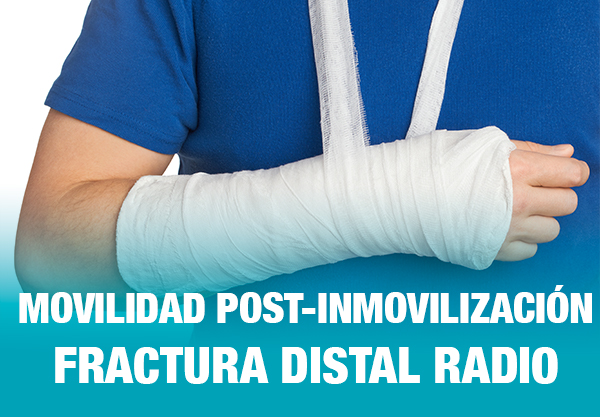 Pocos firma Mecánica Tratamiento Fractura Distal Radio No Quirúrgica. Movilidad  Post-Inmovilización | PHYSIOCIENCIA
